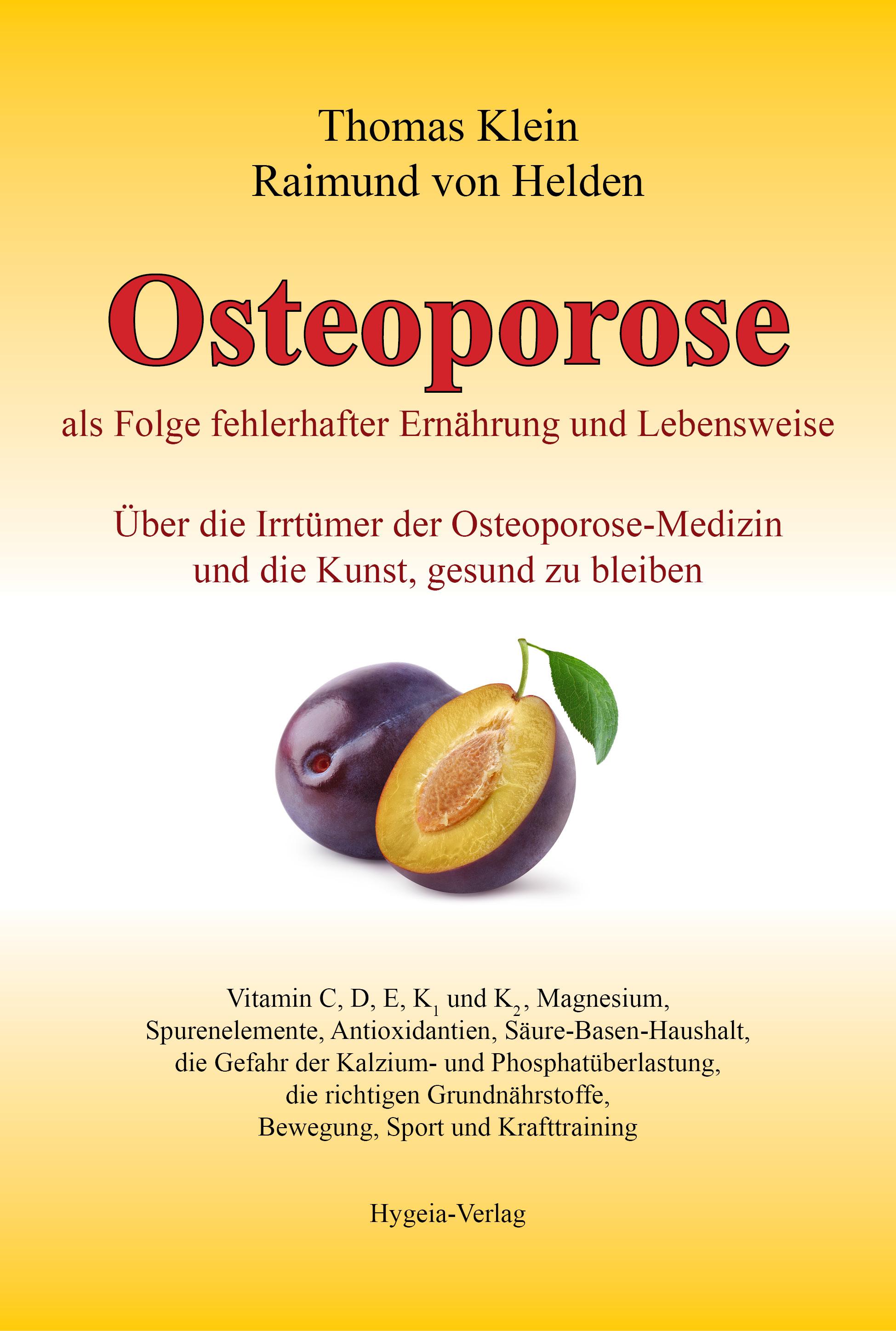 Osteoporose als Folge fehlerhafter Ernährung und Lebensweise Über die Irrtümer der Osteoporose-Medizin und die Kunst, gesund zu bleiben